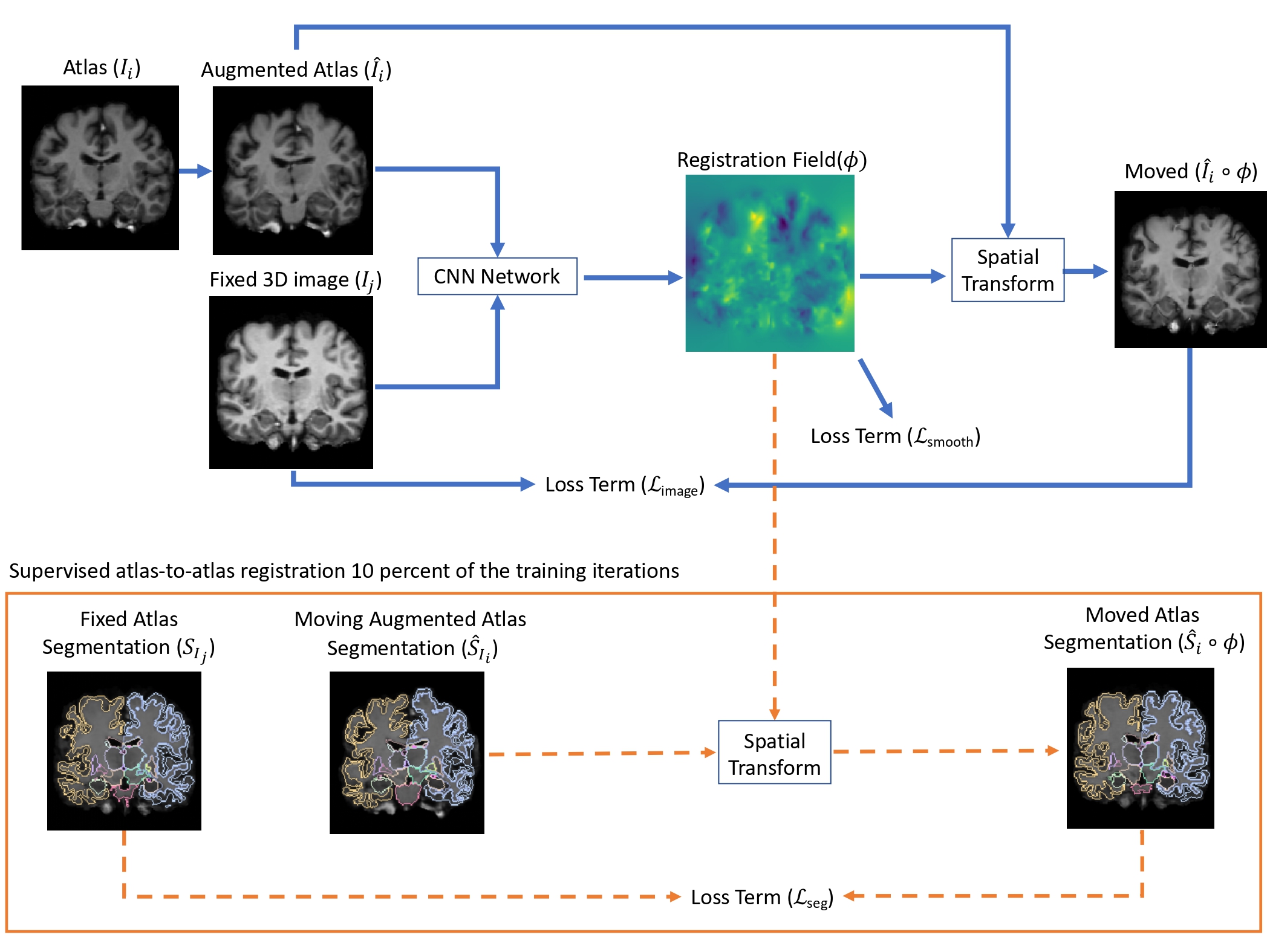 brain segmentation